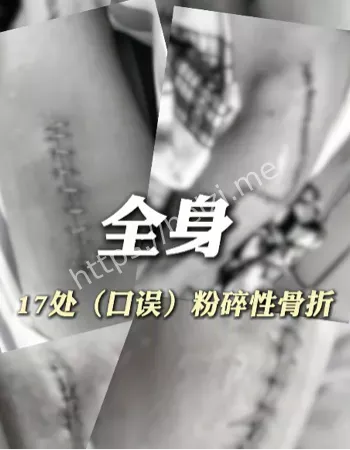 俞某服刑视频出庭