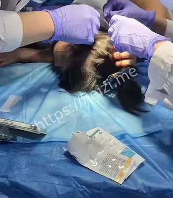 医生判定撕扯致伤