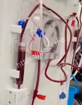 抢救无效身亡警示