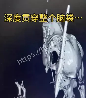救援全程曝光
