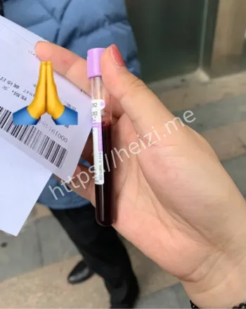 体检查出熊猫血