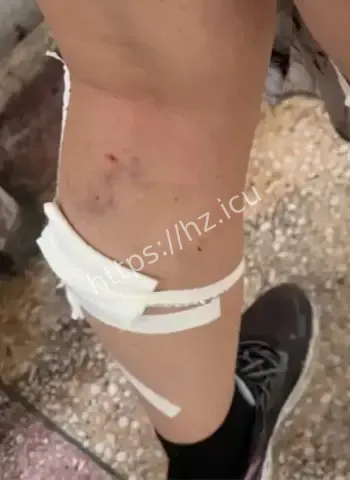 女生被流浪狗围咬