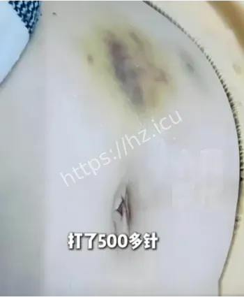 妻子备孕被渣